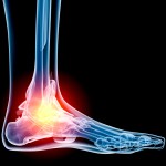 ankle