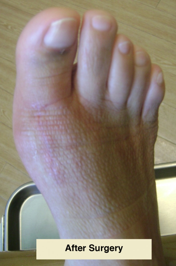 Bunions Foot & Ankle Doctors, Inc.