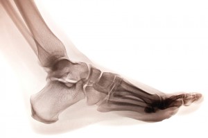 xray